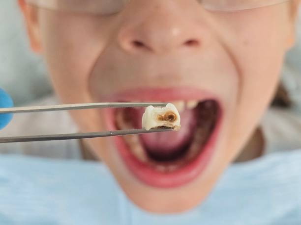 Best Orthodontic Emergency Dentist in Red Lick, TX